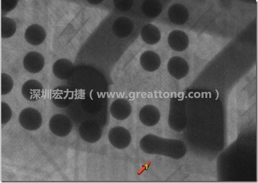 BGA因為焊墊變小，造成錫膏過多而最終形成焊接短路的結(jié)果。